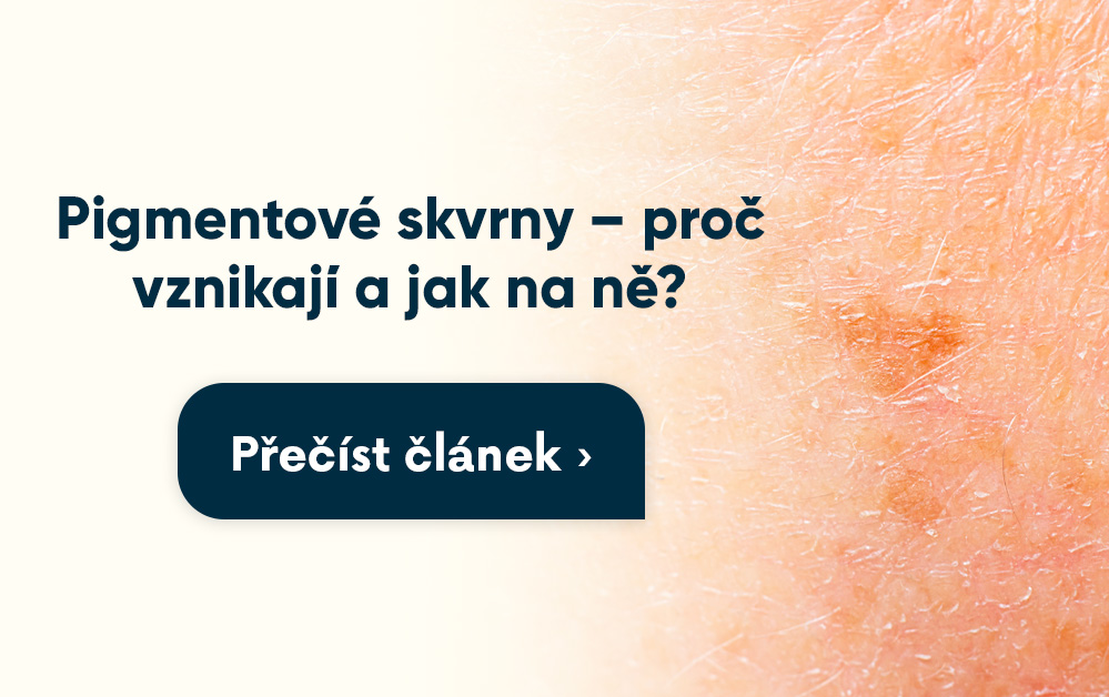 Pigmentové skvrny-mobile